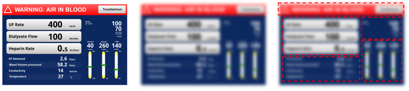 Three illustrated dialysis device interfaces. Middle device blurred, right phone blurred with red dotted rectangles inside.