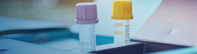 Two test tubes sitting on a desk