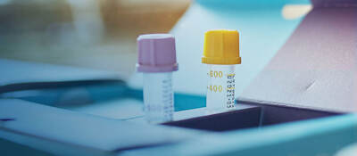 Two test tubes sitting on a desk