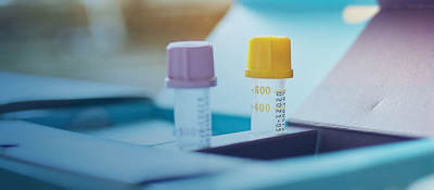 Two test tubes sitting on a desk