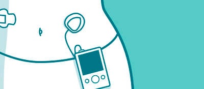 Drawing of a Wearable insulin pump