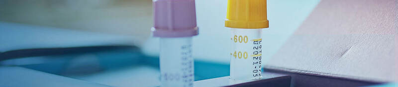 Two test tubes sitting on a desk