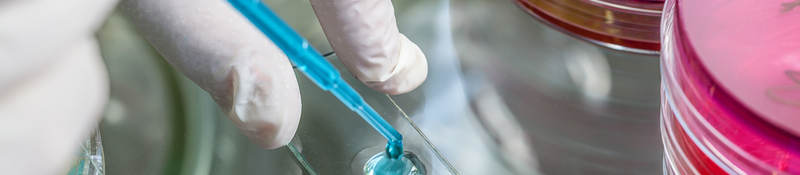 Tech using a pipette to place a specimen on a slide