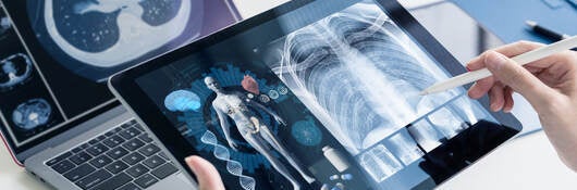 Software as a medical device (SaMD) x-ray images