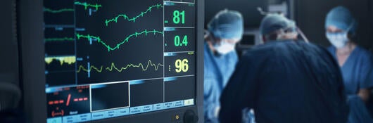 Closeup of a heartrate monitor during surgery