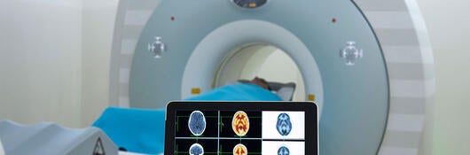 Medical professional reviewing CT scans on a tablet
