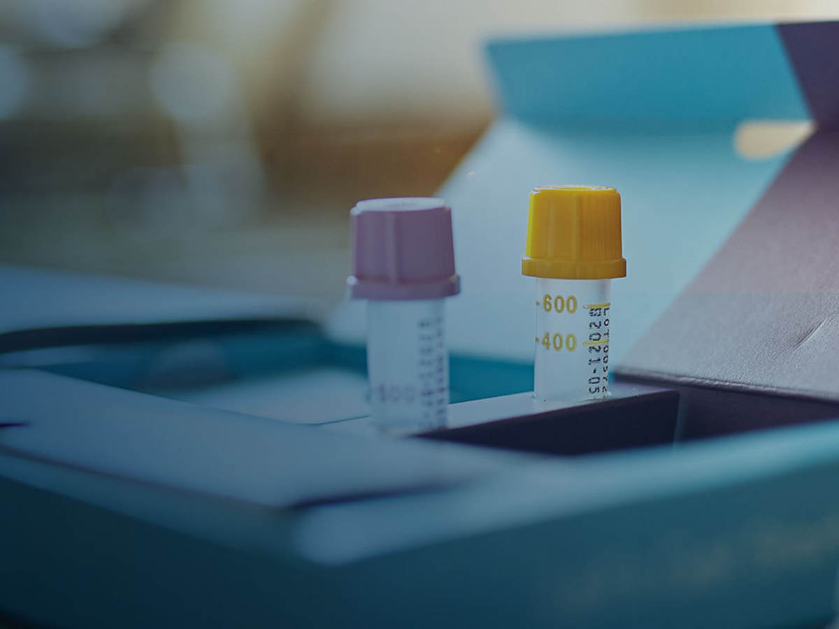 Two test tubes sitting on a desk