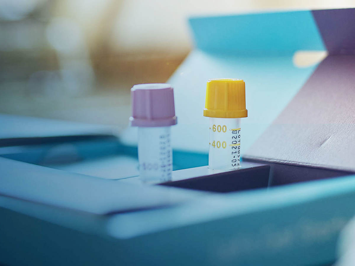 Two test tubes sitting on a desk