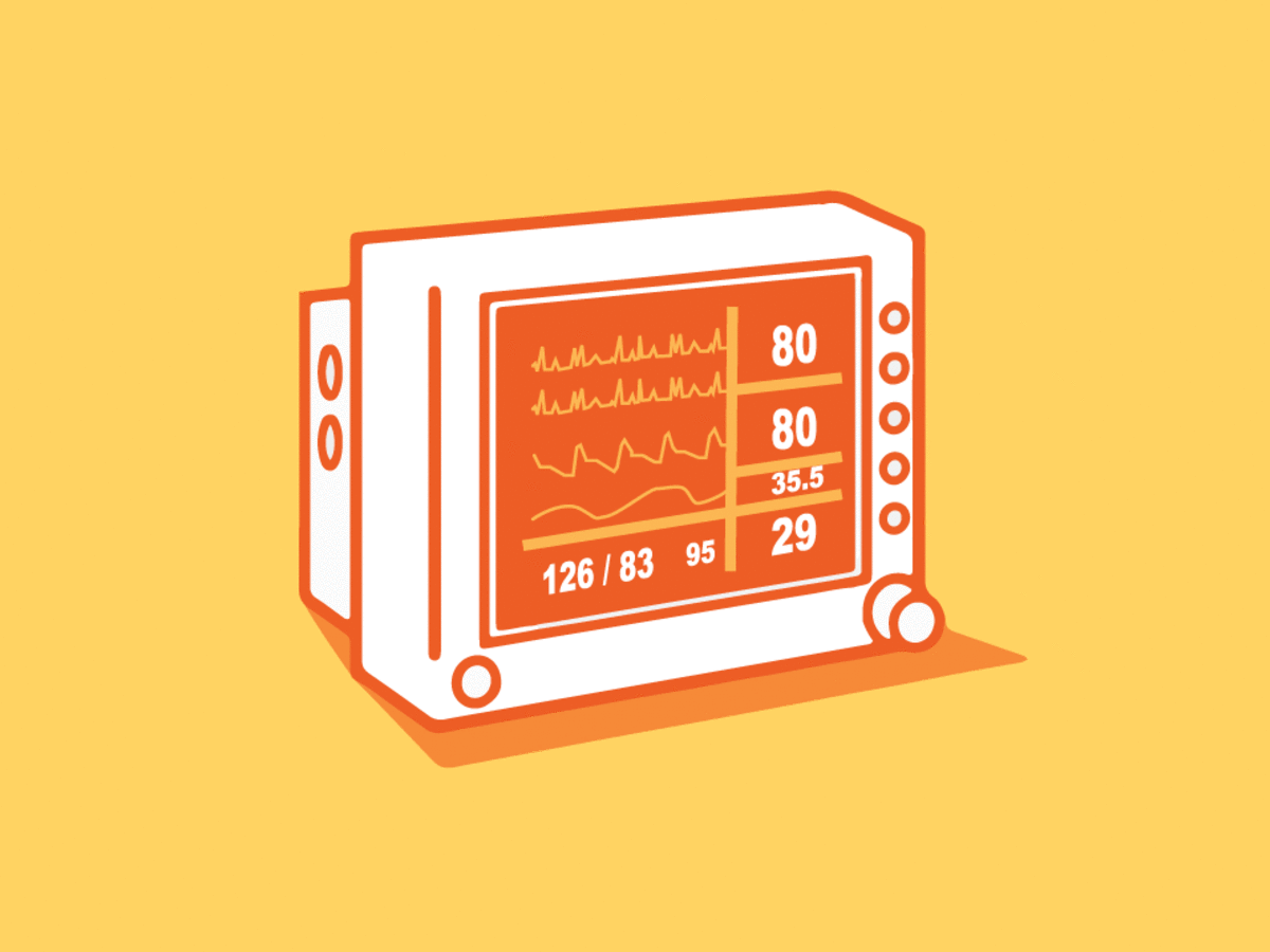 Drawing of monitor in a hospital