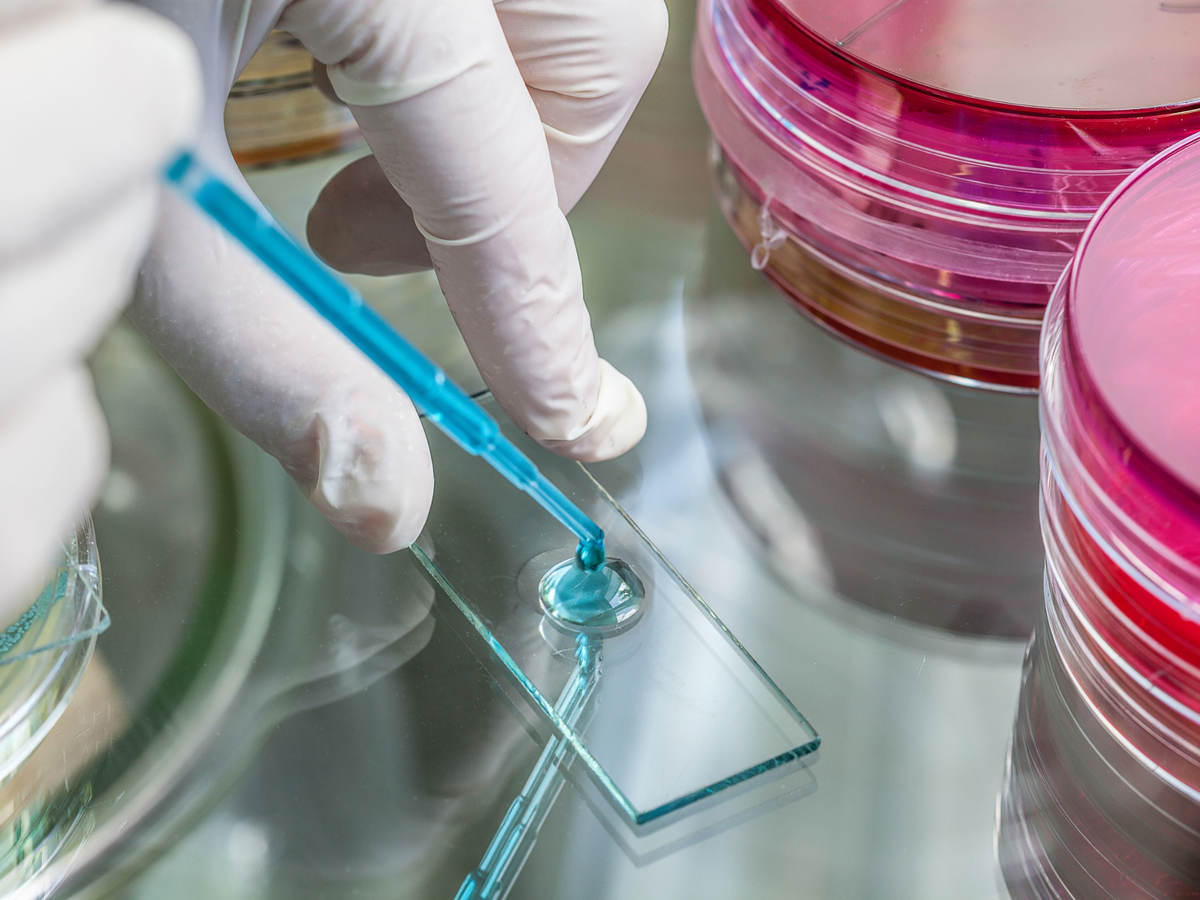 Tech using a pipette to place a specimen on a slide