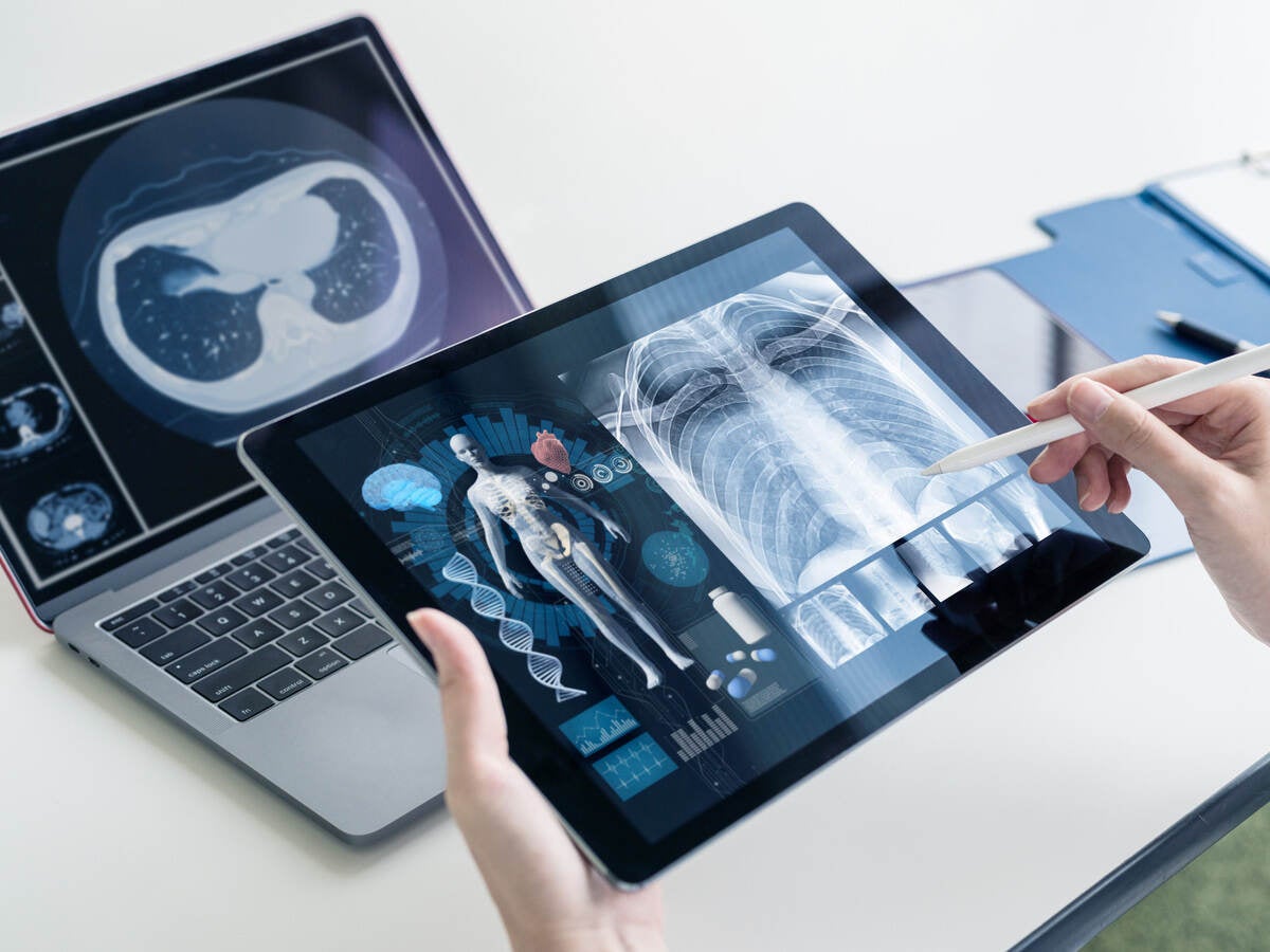 Software as a medical device (SaMD) x-ray images