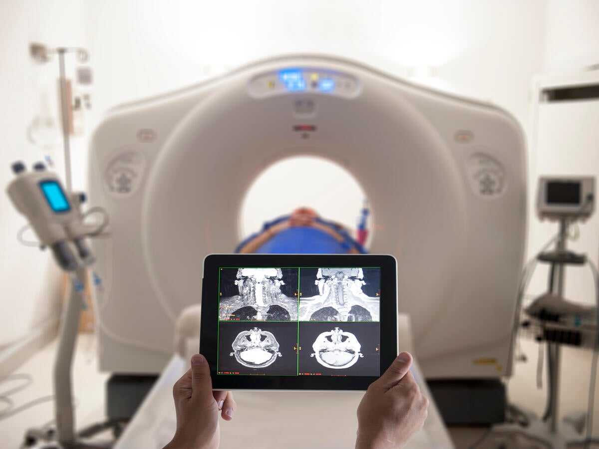 CT scan and results