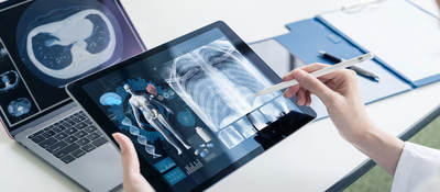 A person is reviewing x-rays on a mobile device